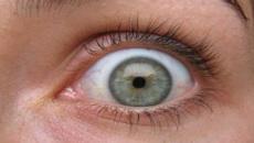 Sâu dài 4 inch xuất hiện ở trán rồi bò lên mí mắt người phụ nữ