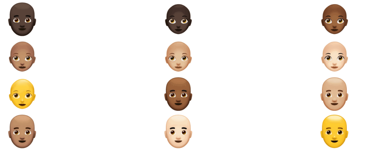 Bạn có hói? Có AI đoán rụng tóc và tư vấn sớm