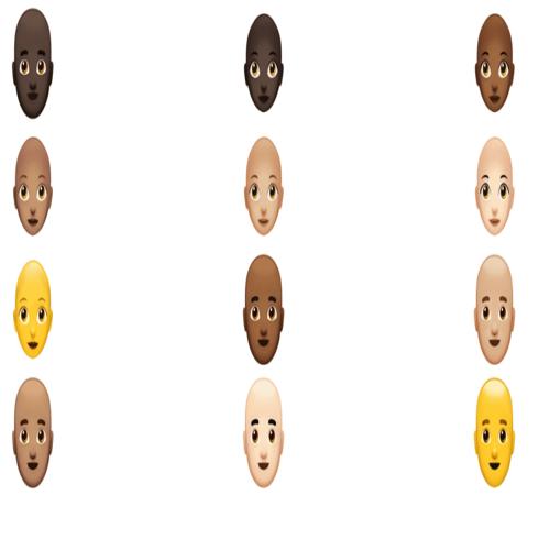 Bạn có hói? Có AI đoán rụng tóc và tư vấn sớm